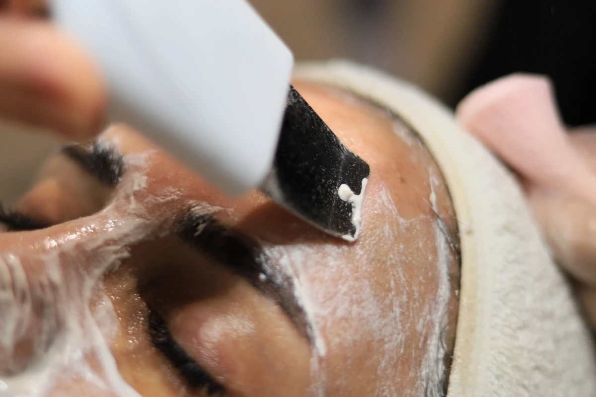 Peeling Yolanda Ugarte